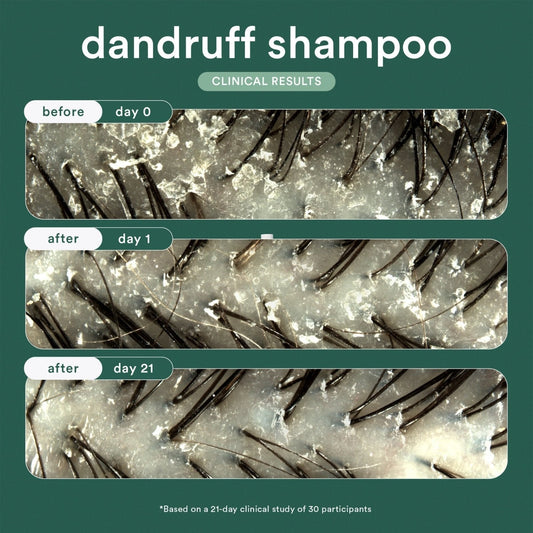 Verb Dandruff Shampoo